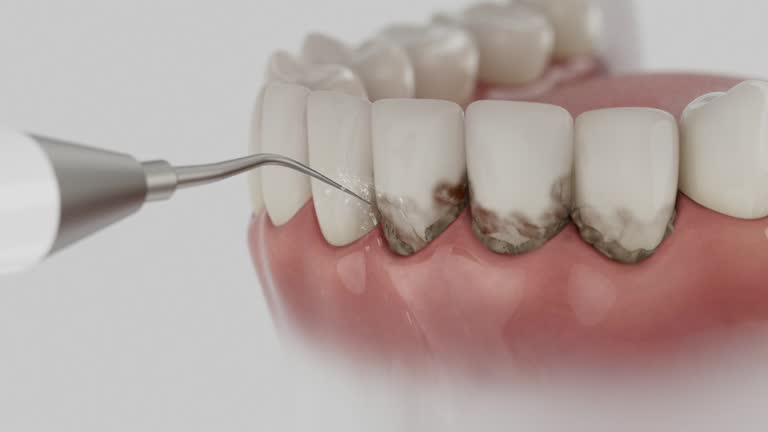 Reliable Dental Implants contractor in Clear Lake, SD by Smile Center Dentistry